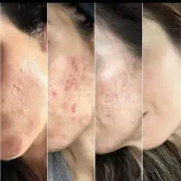 معجزه پوستی میخوای بیا پیشم