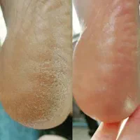 تخفیف استثنایی خدمات ناخن،پدیکور،احیاوصافی مو|خدمات آرایشگری و زیبایی|کرمان, |دیوار