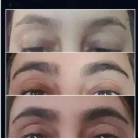 رشد ابرو فقط با یک محصول