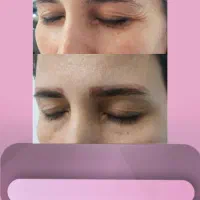 لیزرتتوابرو،لیزرهالیوودی کیوسوئیچ