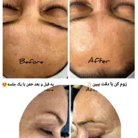 فیشال تخصصی + آموزش فیشال از صفر تا صد|خدمات آرایشگری و زیبایی|شیراز, طلاب|دیوار