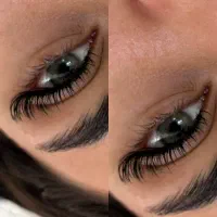 کاشت مژه با جدید ترین مدل های روز بدن اسیب