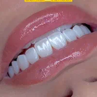 دندانپزشکی دنتال ونیر کامپوزیت لمینت ایمپلنت|خدمات آرایشگری و زیبایی|تهران, تجریش|دیوار