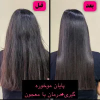 موخوره گیری و تراپی مو شگفتانه