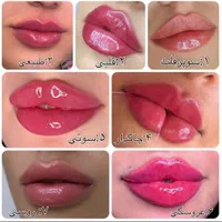 تخفیف ویژه ی   تمام کارهای زیبایی بوتاکس و فیلر