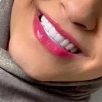 خدمات دندانپزشکی با قیمت مناسب|خدمات آرایشگری و زیبایی|گنبد کاووس, |دیوار