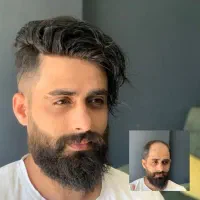 پروتز مو معجزه زیبایی|خدمات آرایشگری و زیبایی|اصفهان, ملک|دیوار