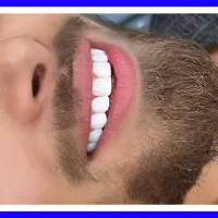 دندانپزشکی/عصبکشی/ترمیم/کامپوزیت/روکش شرق و غرب|خدمات زیبایی و سلامت|تهران, تهرانپارس شرقی|دیوار