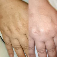 جشنواره یلدایی فشیال و پاکسازی پوست|خدمات آرایشگری و زیبایی|تهران, حکیمیه|دیوار