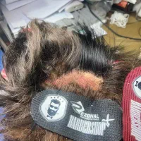 ترمیم. ریختگی موی پروتز و پارگی پوستیژ