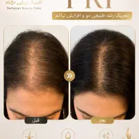 کلینیک زیبایی و مرکز لیزر دژآباد در رودسر