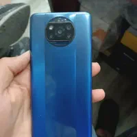 شیائومی ایکس تری پرو