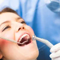 درمان ارتودنسی کودکان ۸تا۱۲سال در دانشکده دندان