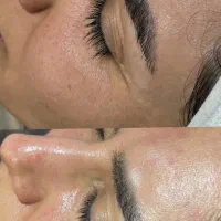 فیشال و پاکسازی صورت|خدمات آرایشگری و زیبایی|شیراز, شهرک فرزانگان|دیوار