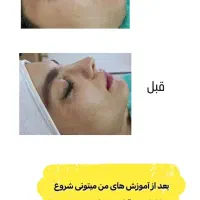 آموزش صفر تا صد پاکسازی پوست با مدرک فنی حرفه ای|خدمات آموزشی|کرمان, |دیوار