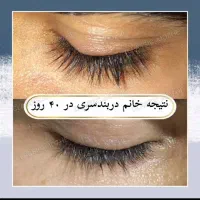 مژه ها و ابروهات رو تقویت و زیبا کن|خدمات آرایشگری و زیبایی|اهواز, گلستان|دیوار