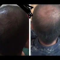 معجزه پک|حراج|قم, باجک دو|دیوار