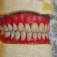 دندانسازی لبخند( بامجوز رسمی ازبهداشت)