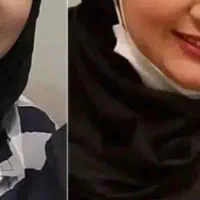 پر و چاقی صورت بدون مواد شیمیایی