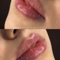 تخصص در بوتاکس و فیلر و جوانسازی|خدمات آرایشگری و زیبایی|شیراز, بعثت|دیوار