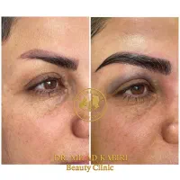 تخفیف استثنایی کاشت ابرو دربهترین کلینیک شهراصفهان|خدمات آرایشگری و زیبایی|اصفهان, بوستان آینه خانه|دیوار