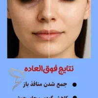 لیزر تخصصی موهای زاید رفع مشکلات پوست پاک کردن تتو|خدمات آرایشگری و زیبایی|شیراز, حافظیه|دیوار