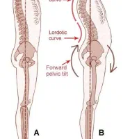 بدنسازی بانوان لاغری وفرمدهی سریع و حرفهای
