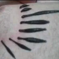 حجامت ،فصدوزالو،سم زدا ویونیزاسیون ماساژ درمانی|خدمات آرایشگری و زیبایی|سنندج, |دیوار