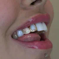 روکش دندان سرامیکی به مدت محدود|پزشکی|تهران, فردوس|دیوار