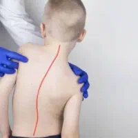 مرکز درمان قوز،گودی کمر،انحراف ستون فقرات و لگن