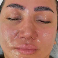 فیشال و(پاکسازی پوست)آبرسانی پوست|خدمات آرایشگری و زیبایی|رفسنجان, |دیوار