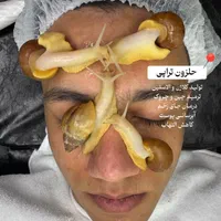 فیشیال تخصصی آقایان « پاکسازی پوست » فشیال فیشال|خدمات آرایشگری و زیبایی|مشهد, الهیه|دیوار