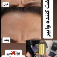 لیفت وایپر|آرایشی، بهداشتی، درمانی|تهران, شهرک محلاتی|دیوار