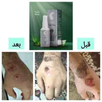 تونیک نانو نقره|آرایشی، بهداشتی، درمانی|کاشمر, |دیوار