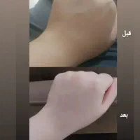 فروش کرم سفیدکننده قوی و ضدلک و آبرسان