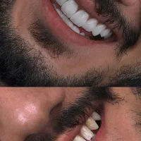 مرکز تخصصی کامپوزیت دندان|خدمات آرایشگری و زیبایی|مشهد, ملک‌آباد|دیوار