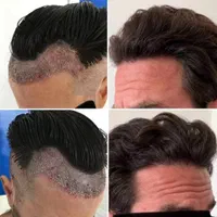 جشنوارهکاشت مو و ابرو و ریش وسبیل|خدمات آرایشگری و زیبایی|اهواز, اسماعیلیه|دیوار