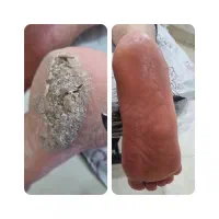 احیاو کراتین مو وپدیکور پا..از تخفیف ها جا نمونید|خدمات آرایشگری و زیبایی|شاهین‌شهر, فردوسی|دیوار