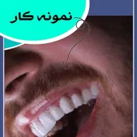 دندانپزشکی با تعرفه 1403|خدمات آرایشگری و زیبایی|اصفهان, باتون|دیوار