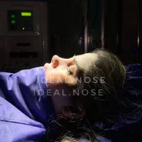 جشنوار عمل زیبایی بینی با تخفیف ویژه