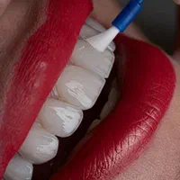 دندانپزشکی اقساطی عصب کشی . کامپوزیت و...|خدمات آرایشگری و زیبایی|قم, عمار یاسر|دیوار