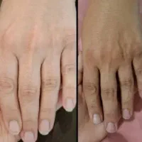 پک جادویی روشن کننده