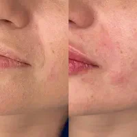 کلینیک تخصصی پوست و زیبایی|خدمات آرایشگری و زیبایی|شیراز, ارم|دیوار