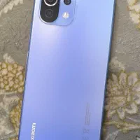 فروش گوشی شیائومی mi 11 lite