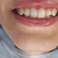 استخدام دستیار و منشی دندانپزشکی