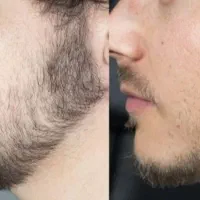 کاشت ممنوع