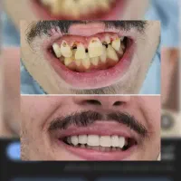 جشنواره بزرگ دندانپزشکی|خدمات آرایشگری و زیبایی|قم, انسجام|دیوار