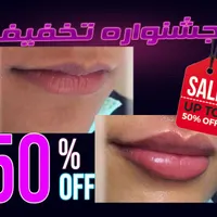 تخفیف تزریق ژل بوتاکس لیفت نخ هایفو فیلرلب لیزر|خدمات آرایشگری و زیبایی|تهران, سعادت‌آباد|دیوار