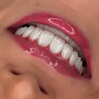 دندانپزشکی ایمپلنت کامپوزیت روکش لمینت‌ ارتودنسی|خدمات آرایشگری و زیبایی|تبریز, |دیوار