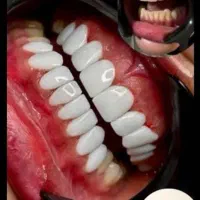 دندانپزشکی و زیبایی بدون پیش پرداخت|خدمات آرایشگری و زیبایی|قم, نوقطار|دیوار